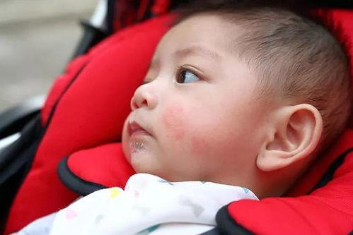 娱乐吃瓜酱过敏,吃瓜酱过敏背后的惊人真相